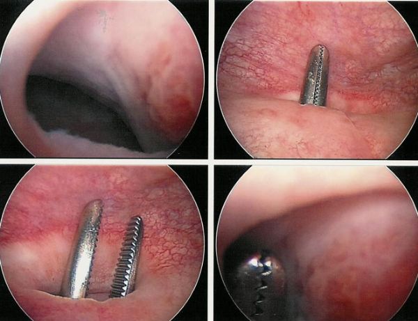 Kamtarona etuk ayollar fotosuratlari Uy qurilishi qattiq anal porno