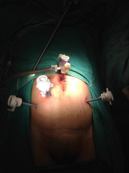 Argentina porno aktrisalar katalog U pushti mushuk va qattiq eshak ichiga lolipop xususda.